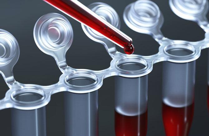 Testing for cardiovascular disease