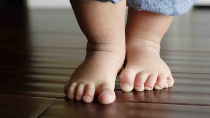 telapak-kaki-datar-pada-anak-perlu-diatasi-dengan-terapi_20170119_172810