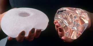 همه چیز درباره پروتز سینه