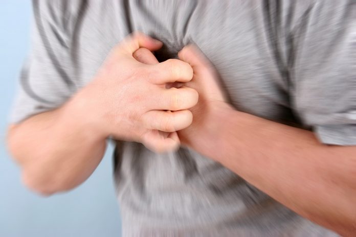 cardiac-arrest
