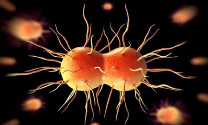 Gonorrhea, symptoms and treatment