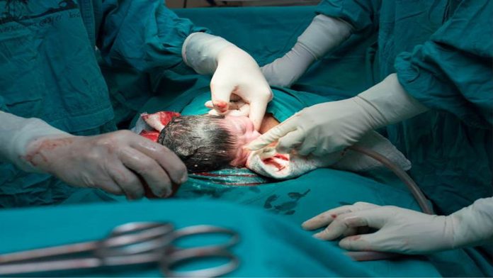 Meetcaesareansection