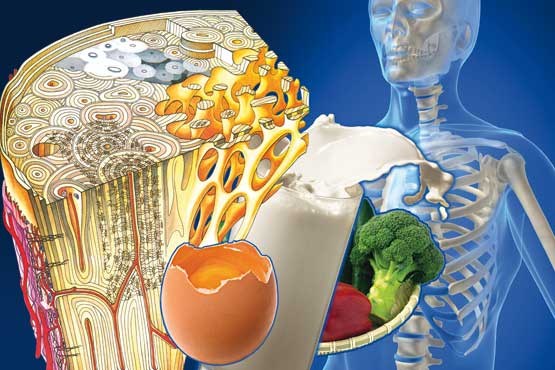 Preventing osteoporosis with regular consumption of dairy products and cereals